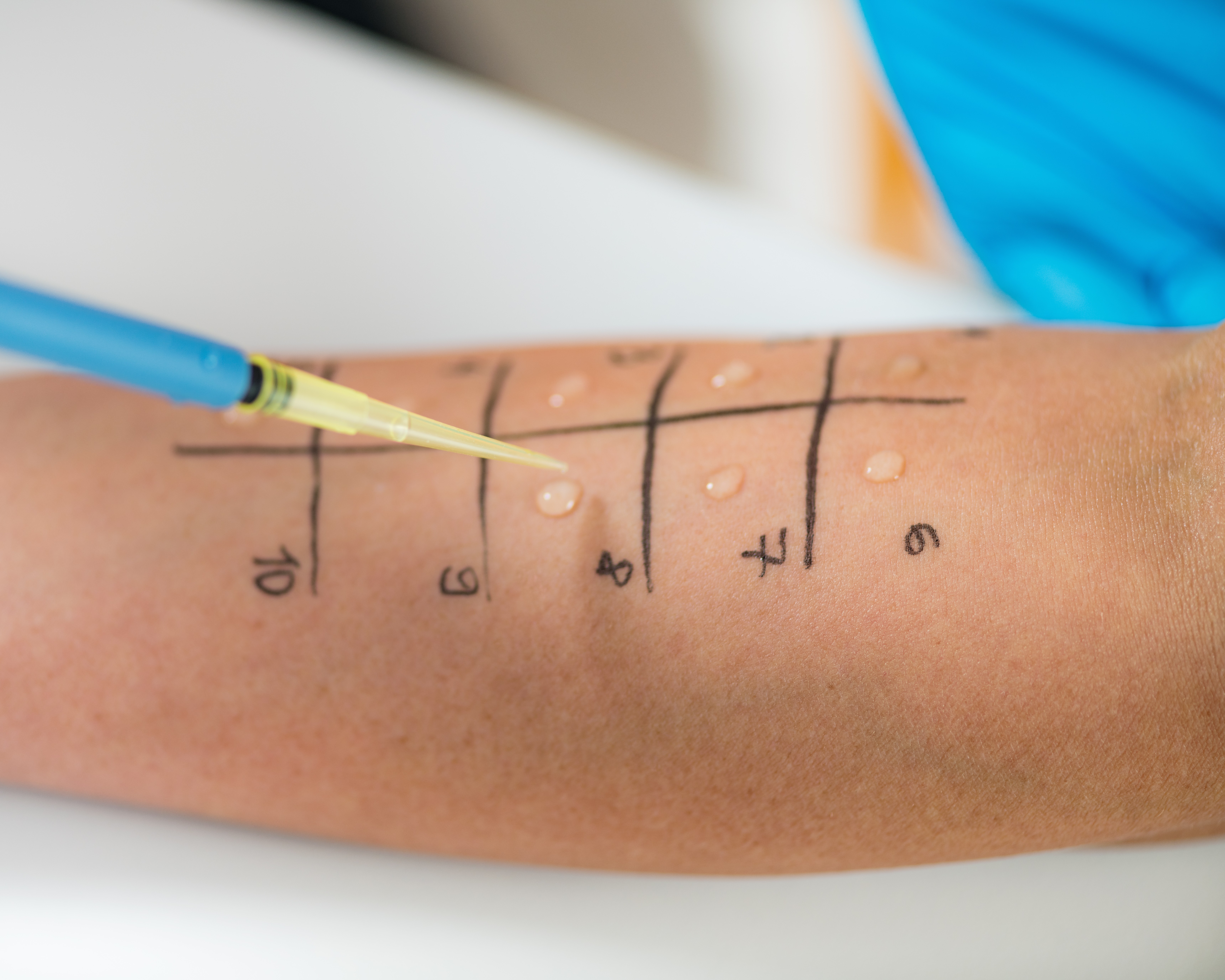 Patch Tests